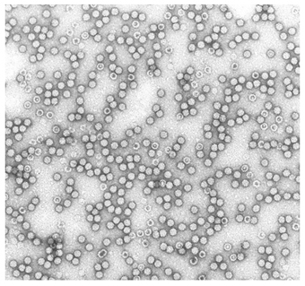 VLPs formadas por la proteína VP2 de la cápsida de Parvovirus (Fotografía de microscopía electrónica)