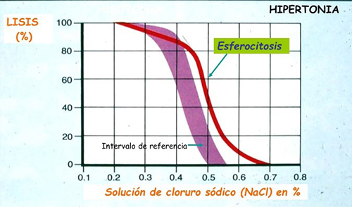 Curva de fragilidad osm&oacute;tica eritrocitaria