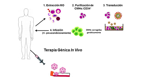 Modalidades de terapia g&eacute;nica: ex vivo / in vivo. Ex vivo: esquema del protocolo de modificaci&oacute;n de c&eacute;lulas hematopoy&eacute;ticas mediante vectores gamma-retrovirales / lentivirales. In vivo: esquema de inyecci&oacute;n directa de vectores adenoasociados a m&uacute;sculo esquel&eacute;tico