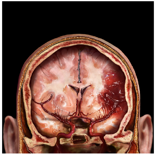 A. Tsiaras, Anatomical Travelogue/The VisualMD©, En la cabeza