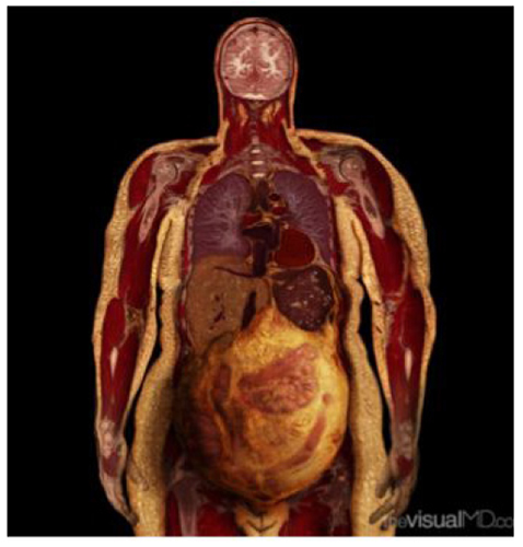  A. Tsiaras, Anatomical Travelogue/The Visual MD©, Embarazo